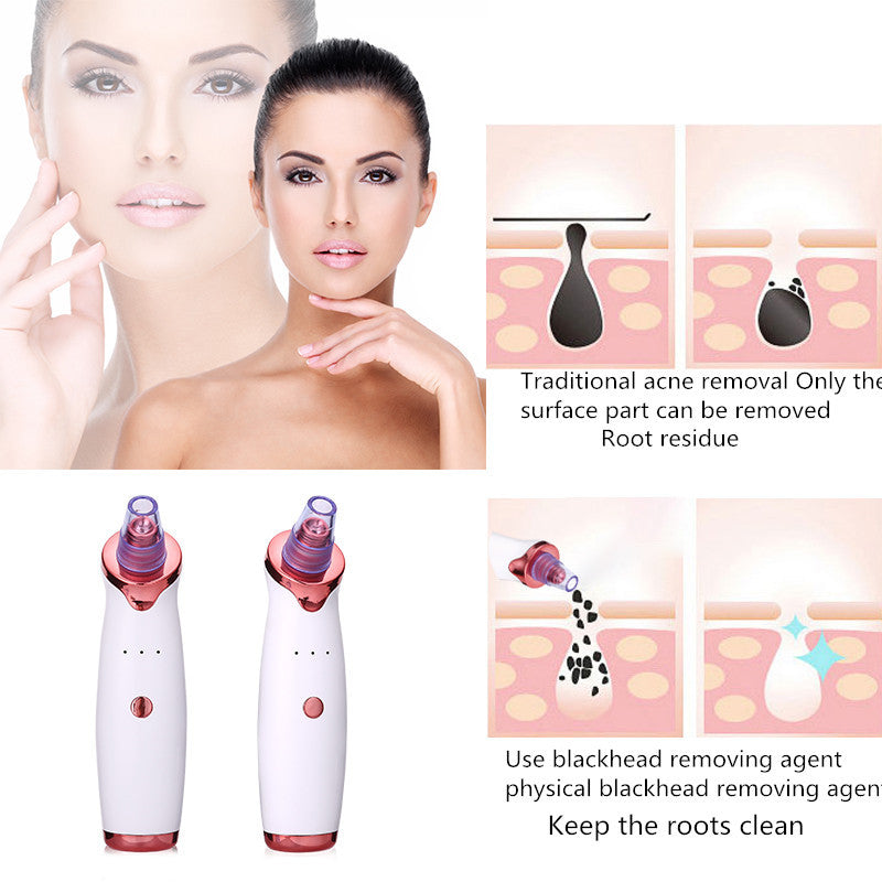 Blackhead Remover (Vacuum Suction Tool)